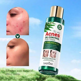 تونر کنترل کننده چربی
